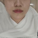 구암동205 | [유성구피부관리/구암동피부관리] 이유에스테틱 1:1 맞춤 컨설팅관리 후기