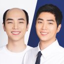 ✨ 은지랑 이은지 X 개그계의 아버지 김용명 위캔두잇 맞춤가발 유튜브 콘텐츠 촬영 후기!