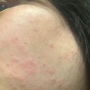 아주고운피부과의원 이미지