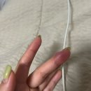오산현대정형외과의원 | 인천 손톱주변통증 | 조갑주위염 진료 피부과보단 정형외과로