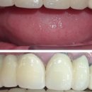 진플란트치과의원 이미지