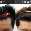 연세모나의원 네이버블로그