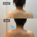 셀럽바디 | [구미 웨딩관리] 셀럽 5050에스테틱, 드레스핏을 위한 바디관리 후기!