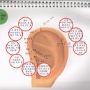 이혈요법 이미지