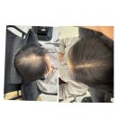 안나헤어샾 - 서대문구 | 출산후 빠져버린 머리카락 다시 채워지다 #일산,파주헤어중모술