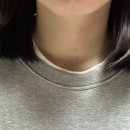 부천서울유외과의원 네이버블로그