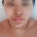 김해시보건소 | 김해에스테틱 [뽀슌에스테틱] 웨이브리프팅 받고 온 후기