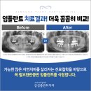 삼성플란트치과의원 이미지