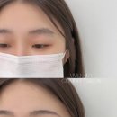 비비드헤어(VIVID HAIR) - 수원시 팔달구 | 창원눈썹반영구 얼굴형, 눈매까지 보는 1:1 맞춤 상담 비비드아트 후기