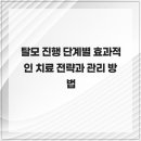 탈모 진행 단계별 효과적인 치료 전략과 관리 방법