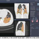 원메디테크 이미지