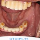 전남치과기공소 이미지