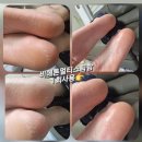 인셀덤 대구 이미지
