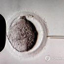 수정 이미지