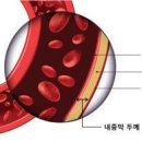 나에게 치매 올지 미리 아는 방법 찾았다 이미지