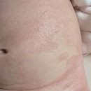 부산성모병원 | 부산 성모병원 소아과 김성원 원장님 아토피 진료, 이제 오픈런 하실 필요 없어요