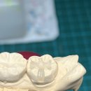 설 치과기공소 이미지