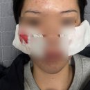 하나메디컬 | 서일메디컬그룹 리쥬란 후기