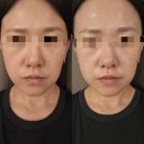 도담동도램마을상가앞BRT | 도담동피부관리 승모근 바디케어 리프팅 잘하는 곳 뷰티에 반하다