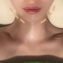 부경메디칼 | [경성대 윤곽관리] 카라에스테틱 : 1인 맞춤 윤곽관리 잘하는 곳