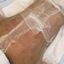 약초206 | [안산 피부관리] 13년 차 피부과 출신 원장의 진짜 '약초필' 이야기 (웨딩케어, 여름 휴가 준비 필수!)