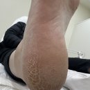 레푸스구미