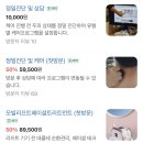 경기 광주 두피케어 스파오라스칼프 방문 후기｜원형탈모집중관리
