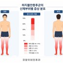 세종코아이비인후과의원 | 세종시 하지불안증후군, 잠 못 드는 이유 <공개>