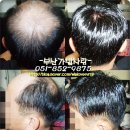 가발스토리