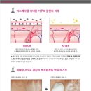 이노클린