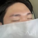 아인뷰티의원 이미지