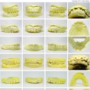 바른치과기공소 이미지