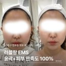 Luvlang(러블랑) | 강동구피부관리 러블랑 비대칭윤곽 윤곽관리 EMS피부 리얼 후기