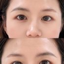 안나의눈썹 이미지