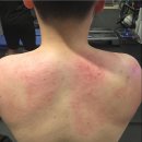 마법의손 리우 통증은 일주일만에 해결!!