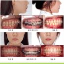 허브스트 이미지