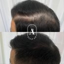 일산두피&눈썹단미토탈뷰티