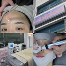 부산 해운대 달맞이 플라즈마 시라필 받고 물광피부 된 후기 : 힐링디데이 스킨&amp;바디
