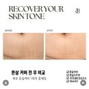 서오메디칼 | 강남 스킨케어 튼살타투 후기 아프지 않아 만족