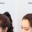 박헤어라인 네이버블로그