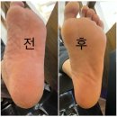 뷰티샤네일