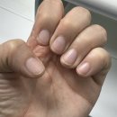 손톱만들기 | 네일포르메 :: 안산 아크릴 샵 물어듣는 손톱 교정 후기