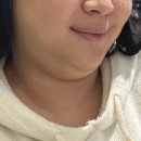 반월당자연사랑약국 | 대구 반월당 얼굴무한람스 부작용 통증 후기