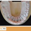 다이안치과기공소 이미지