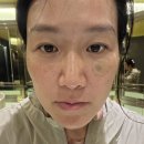 에스메디칼 | 동탄 에스플랜의원, 첫 방문 솔직 후기!