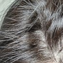 브이원 | 머리 가려움, 비듬 제거 샴푸 "브이원 두피케어 프로 샴푸" 후기