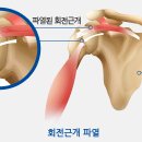 짐볼밴드 이미지