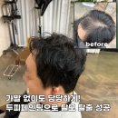 두피페인팅 가격 가발 벗고 탈모커버 성공! 40대 고객님의 리얼 후기