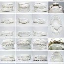 바른치과기공소 이미지