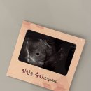 미주예 | 출산 후 톺아보는 임신 기록 - 2. 임산부 락페 가도돼요? #미주신경성실신